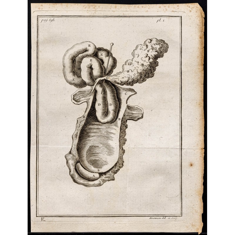 Gravure de 1781 - Intestins - 1