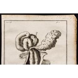 Gravure de 1781 - Intestins - 2