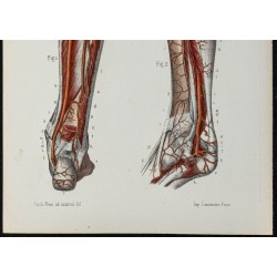 Gravure de 1866 - Angiologie & Artères de la jambe - 3