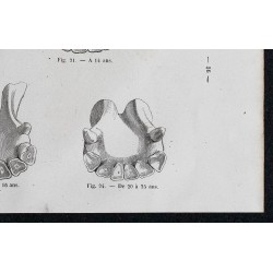 1861 - Mâchoires de cheval de 12 à 25 ans 